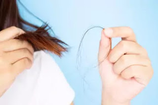 How Much Hair Loss Is Normal? How Much Hair Loss Is Normal?