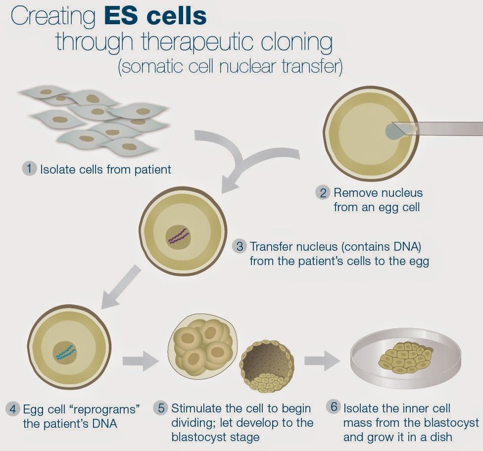 Therapeutic Cloning