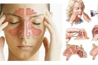 alerjik rinit nedir belirtileri ve