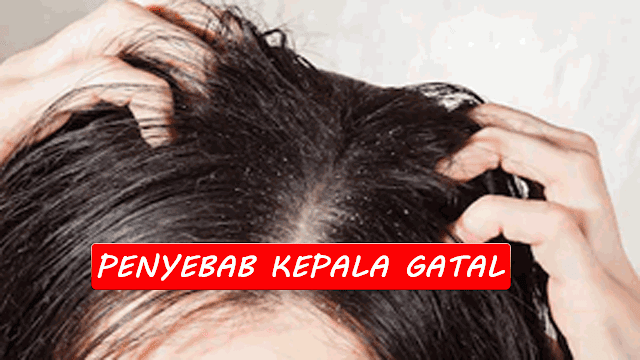 Penyebab Kulit Kepala Gatal 