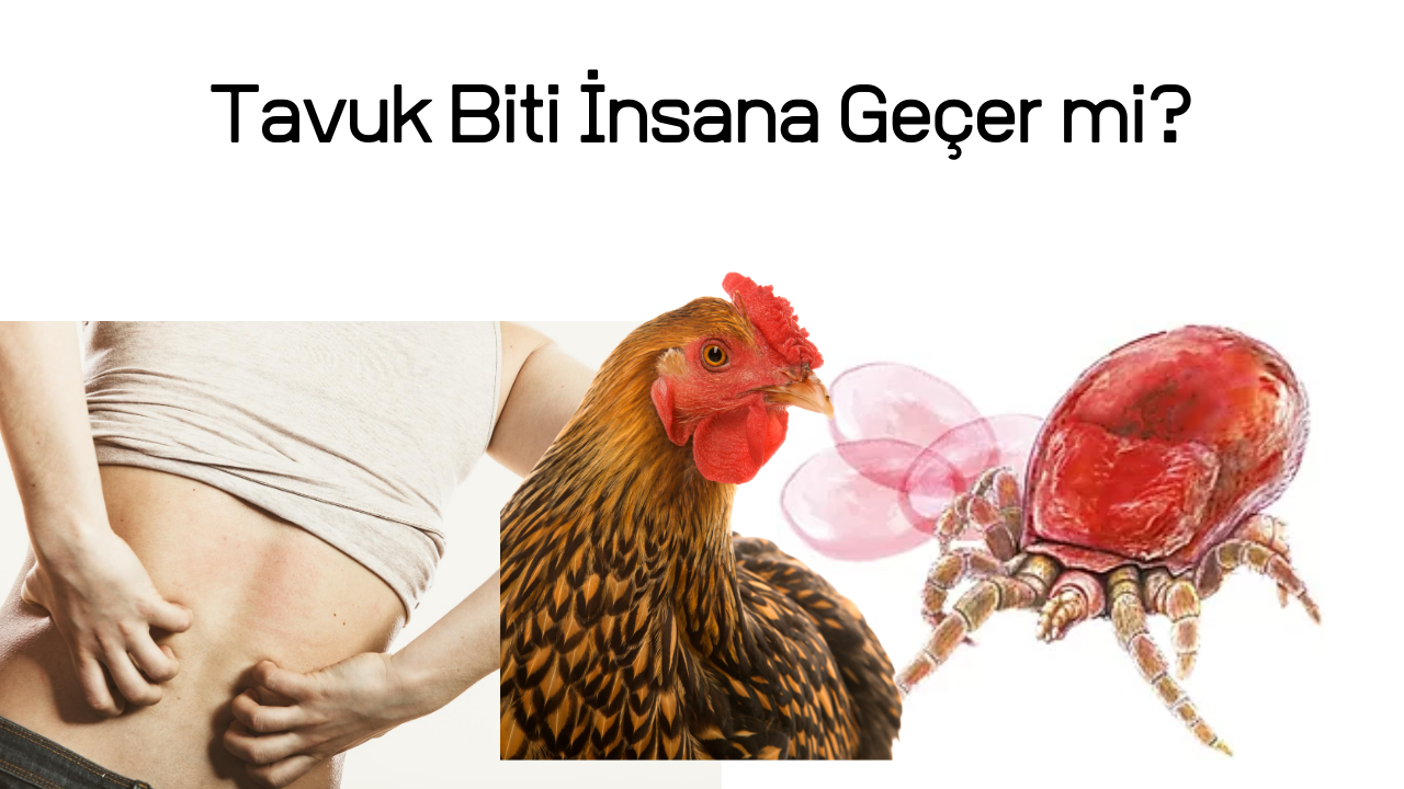 Tavuk Biti İnsana Geçer mi?