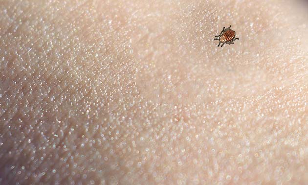 With these easy simple home remedies get rid of bed bugs