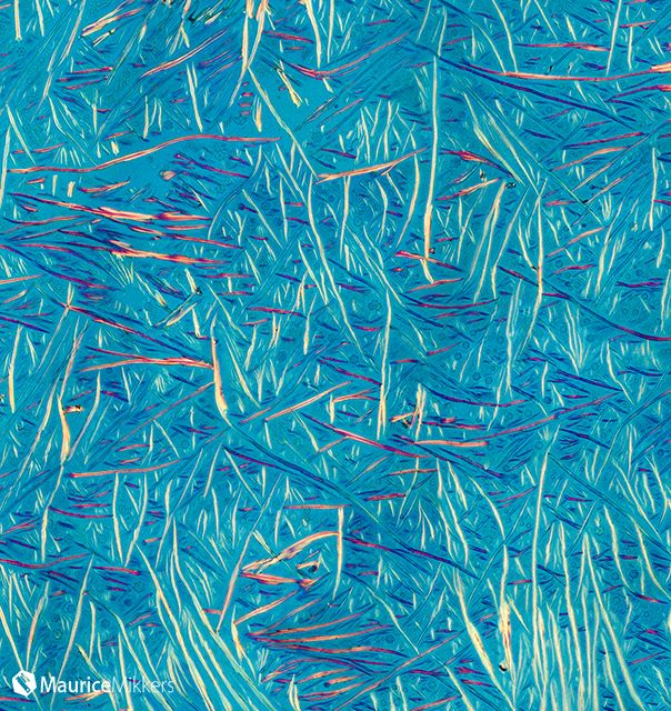 Polarizing microscopy image of caffeine.