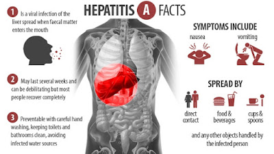 Prevention Hepatitis A, B, and C