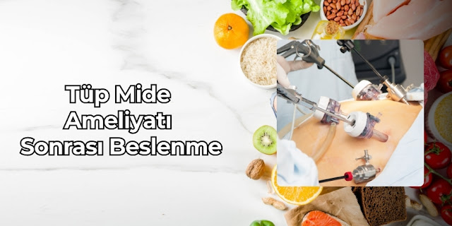 Tüp Mide Ameliyatı Sonrası Beslenme