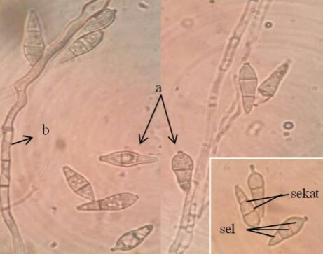 Penyakit Blas Tanaman Padi