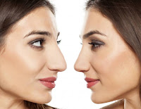 Cum este posibil sã îti schimbi forma nasului de acasa