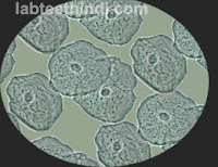 Urine Microscopic - Epi cells