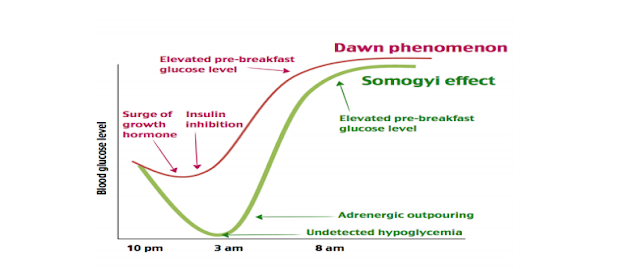 Hiện tượng bình minh và Hiệu ứng Somogyi ở bệnh nhân đái tháo đường