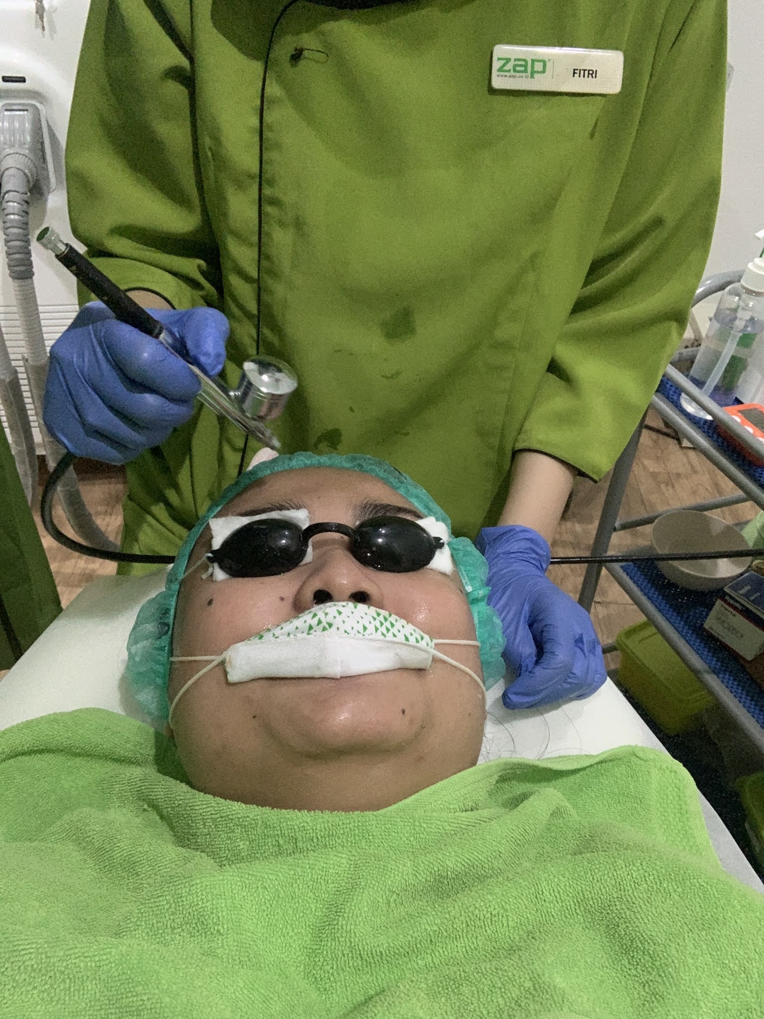 ZAP PHOTO FACIAL ACNE REVIEW IchaMauCerita