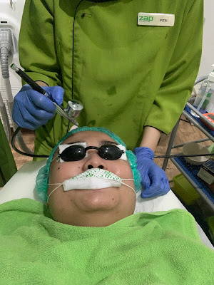 ZAP PHOTO FACIAL ACNE REVIEW ZAP PHOTO FACIAL ACNE REVIEW
