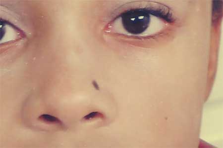 Beauty Spot On Nose - Til Or Mole On Nose Meaning And Importance