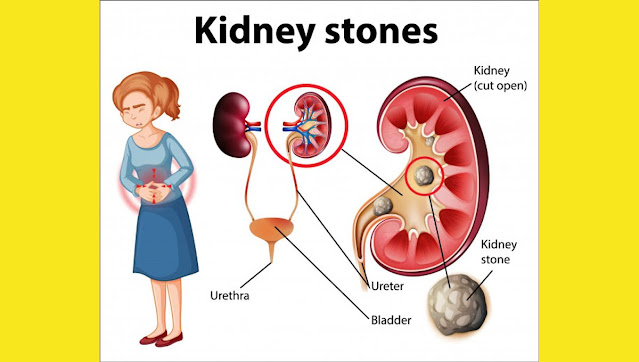 Chronic kidney disease and Symptom
