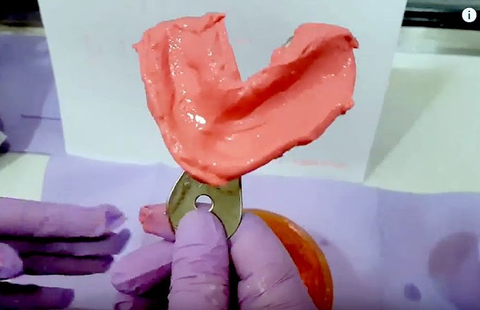 DENTAL IMPRESSION: How to prepare ALGINATE