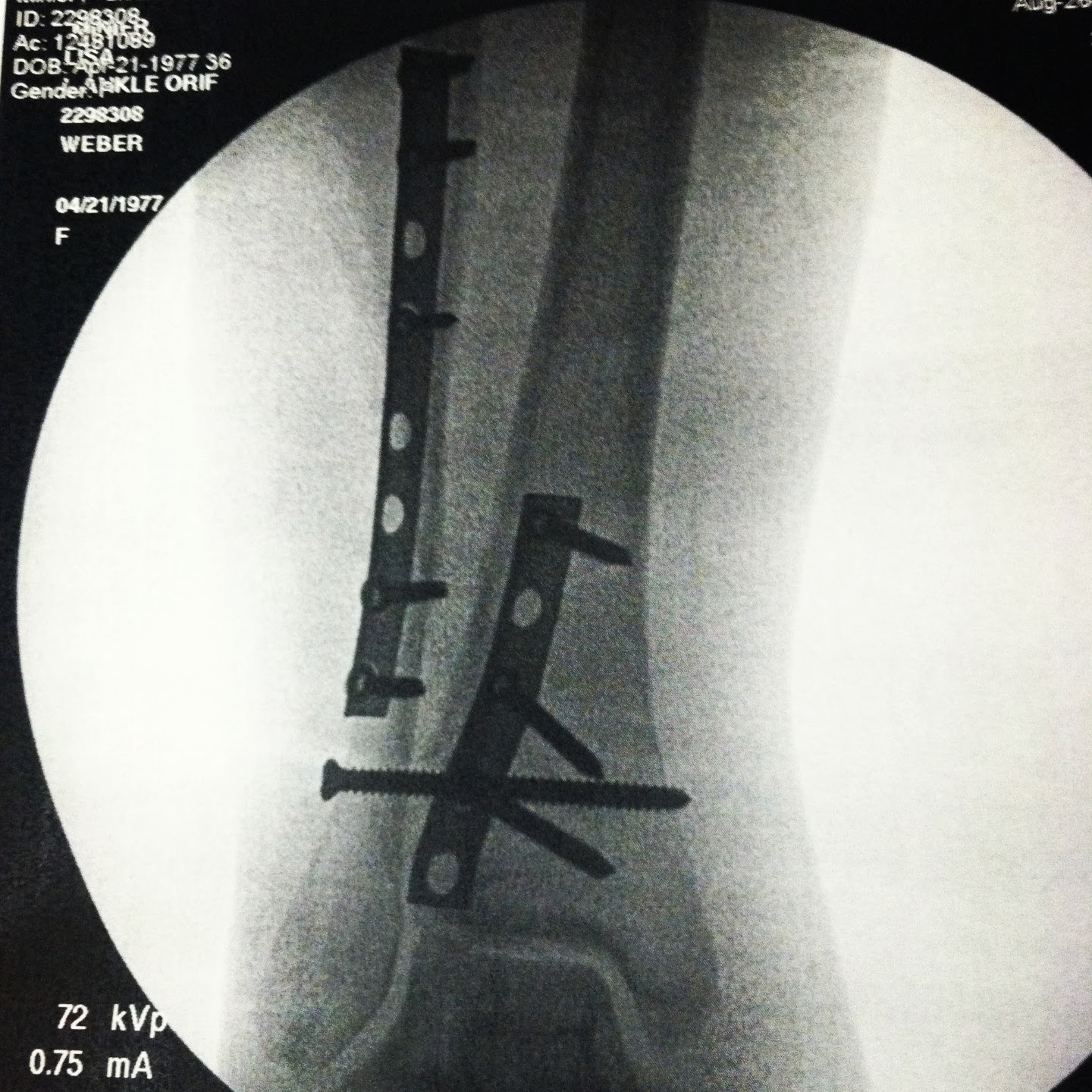 Mermaid's ocean: Broken leg and dislocated ankle