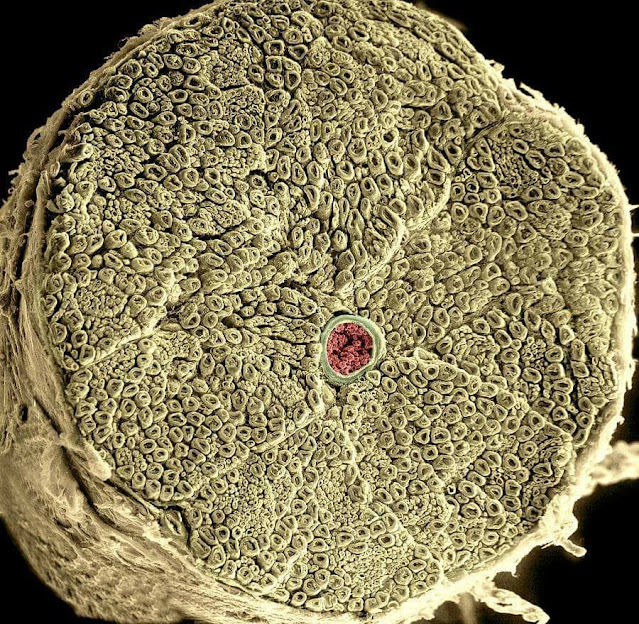 عصب نخاعي spinal nerve تحت الميكروسكوب