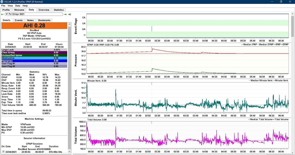 CPAP Health Issues Stop Alzheimer