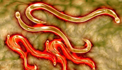 Cacing parasit dalam perut