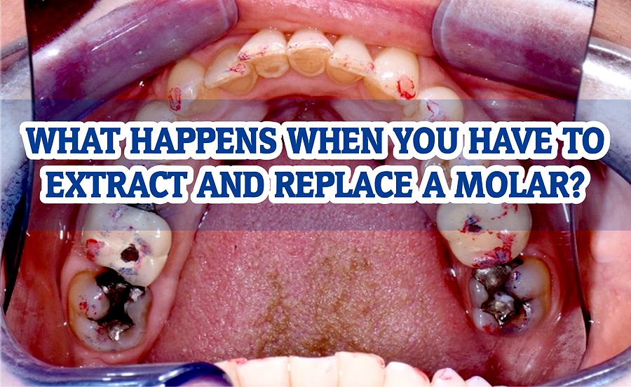 What Happens When You Have To