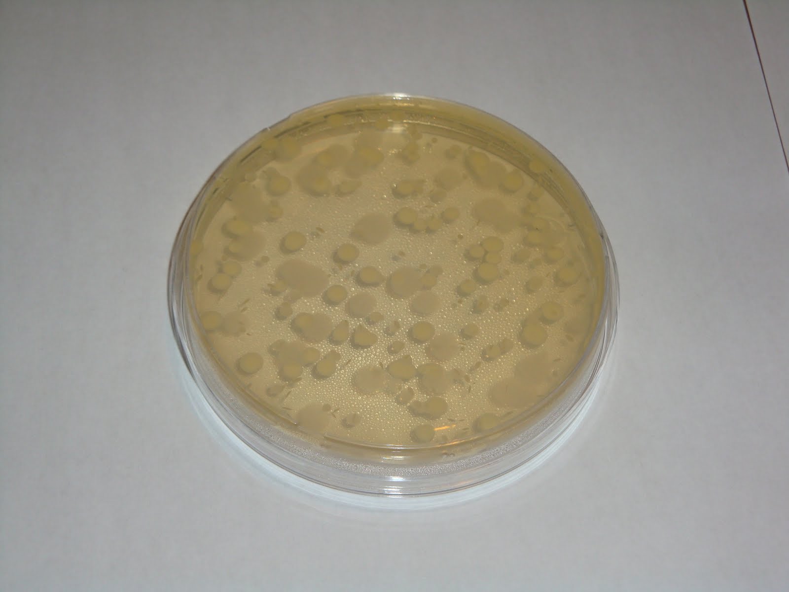 The Bacteria Growth Experiment: A Great View of the Petri Dish