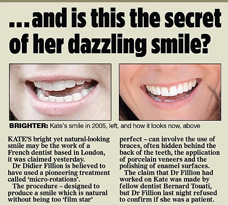 Everything British: Get Teeth like a Duchess!
