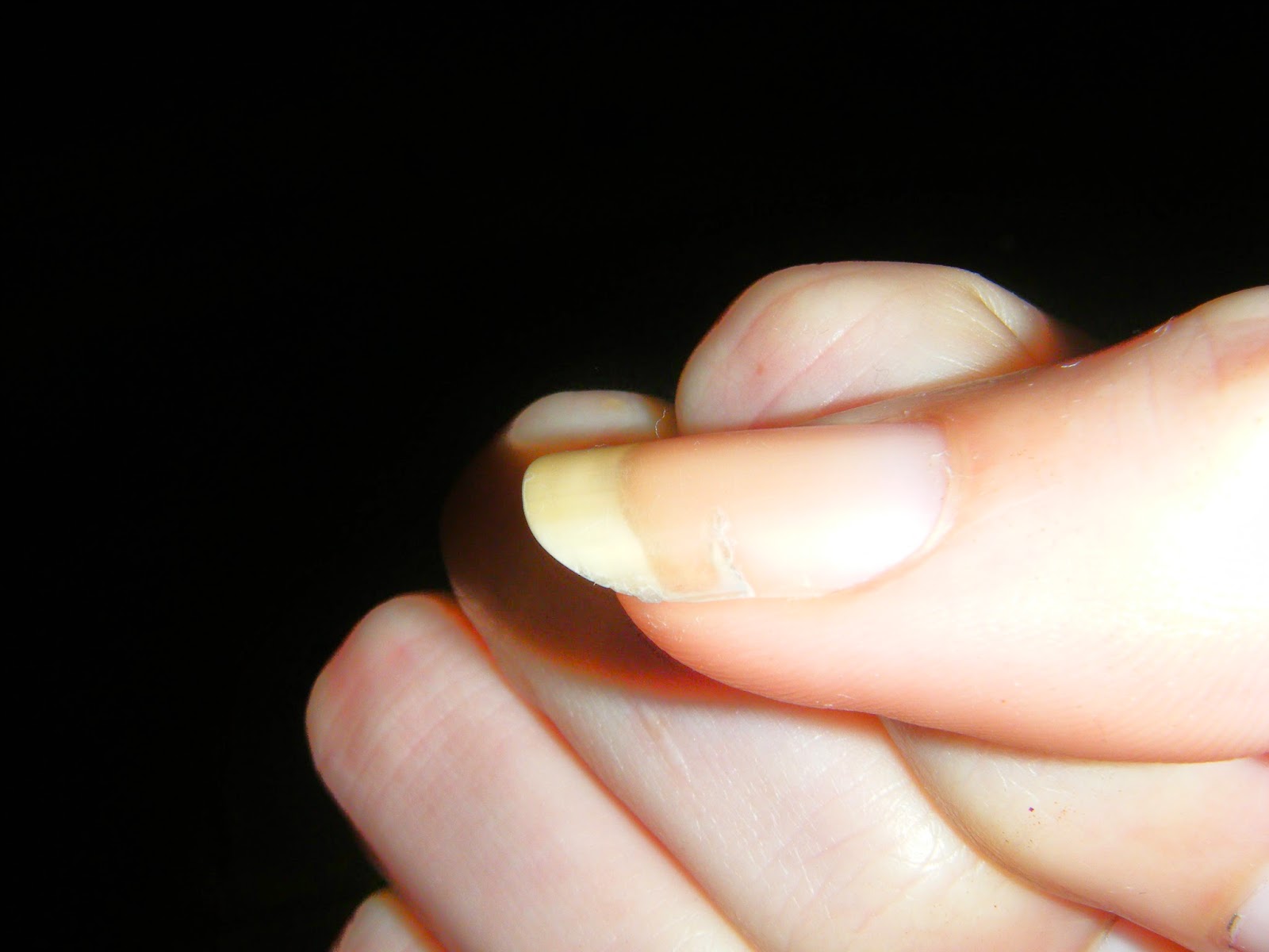 сломанный ноготь во сне