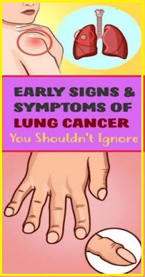 Initial Notice Signs of Lung Cancer You Shouldn’t Ignore!