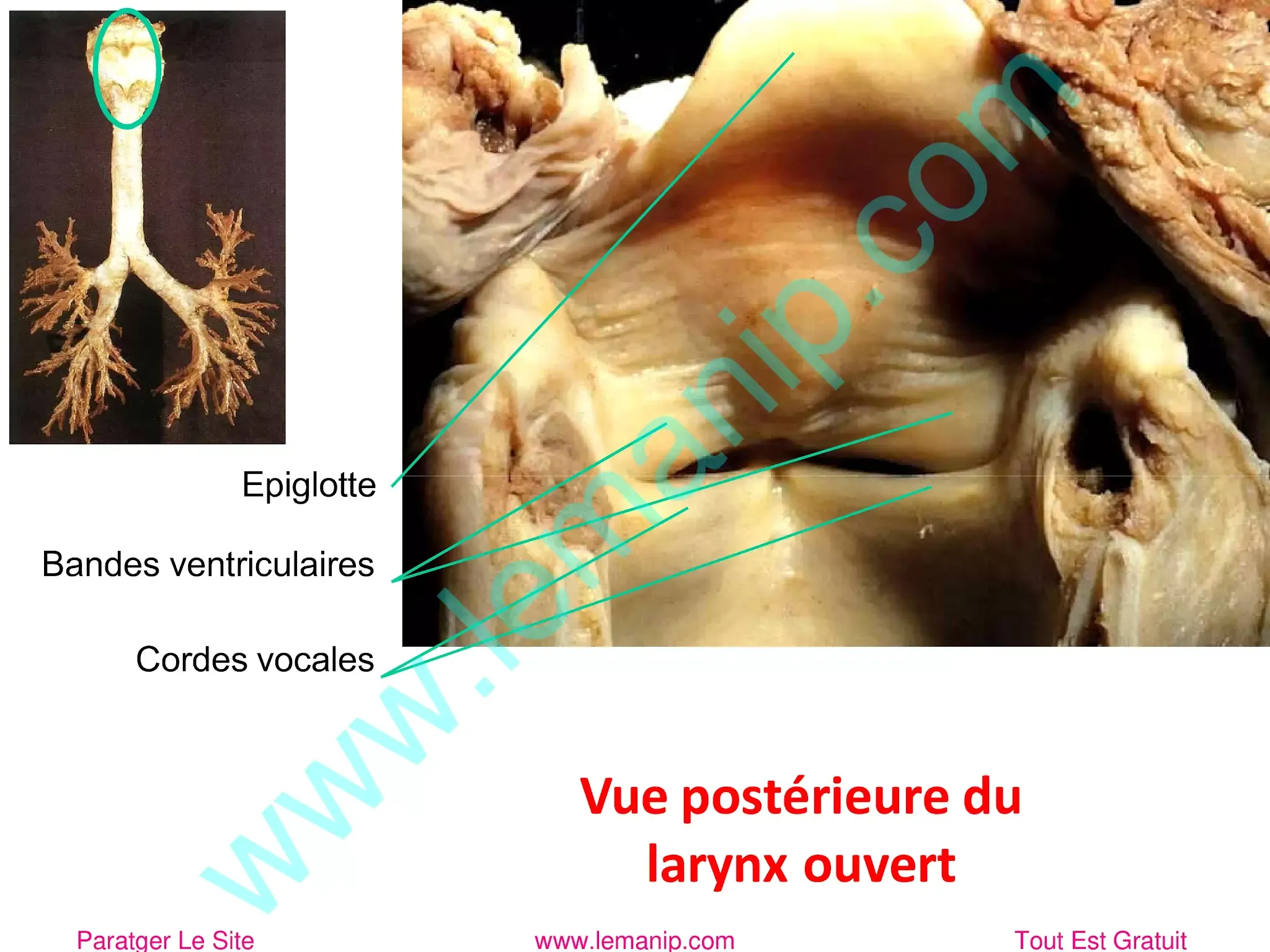 Vue postérieure du larynx ouvert