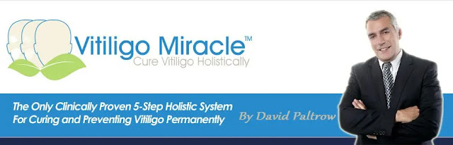 Vitiligo solution with David Paltrow Vitiligo solution with David Paltrow