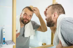 receding hairline treatment receding hairline treatment