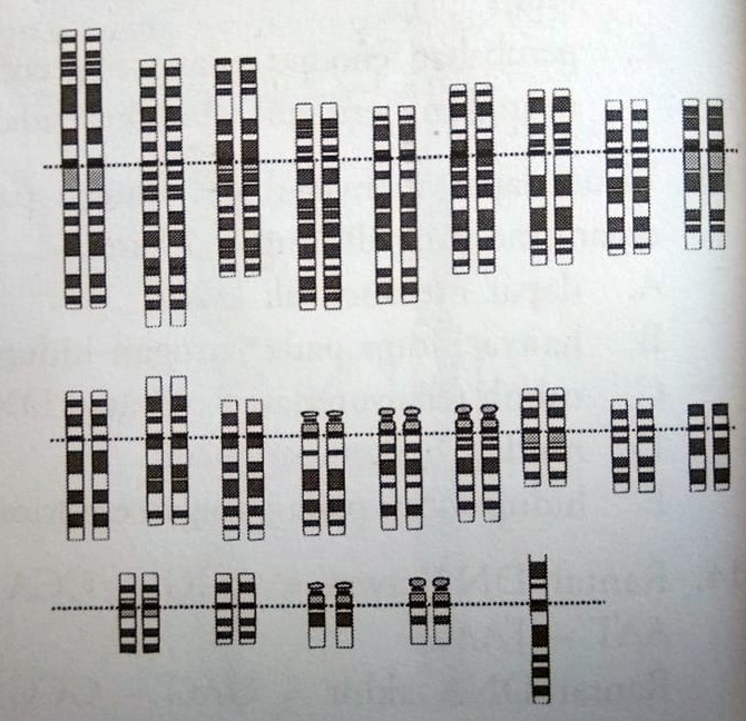 Perhatikan gambar berikut. Berdasarkan peta kromosom tersebut, ciri