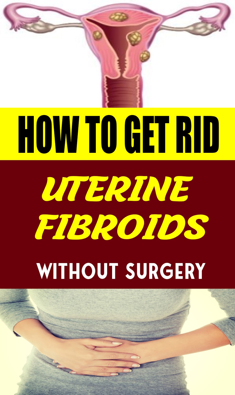 How to Get Rid of Uterine Fibroids without Surgery Momy