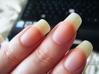 Best options to remove yellow stain from finger nails