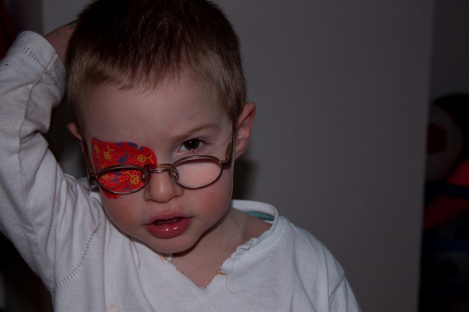 Orli Just Breathe Ocular Albinism orli-just-breathe-ocular-albinism