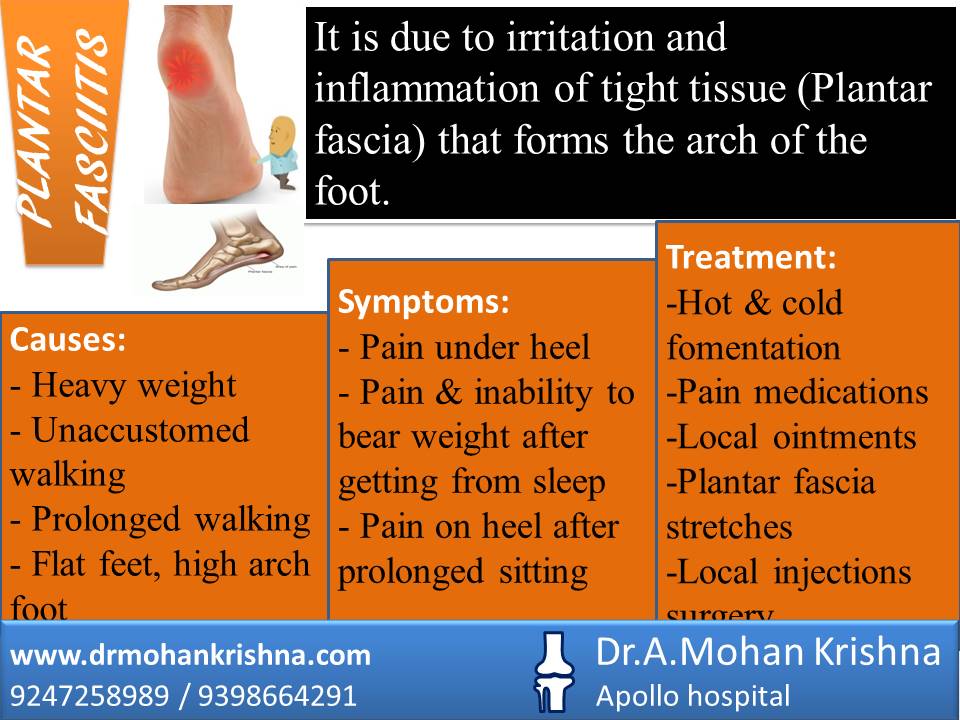 ORTHOPEDIC DOCTOR PLANTAR FASCIITIS