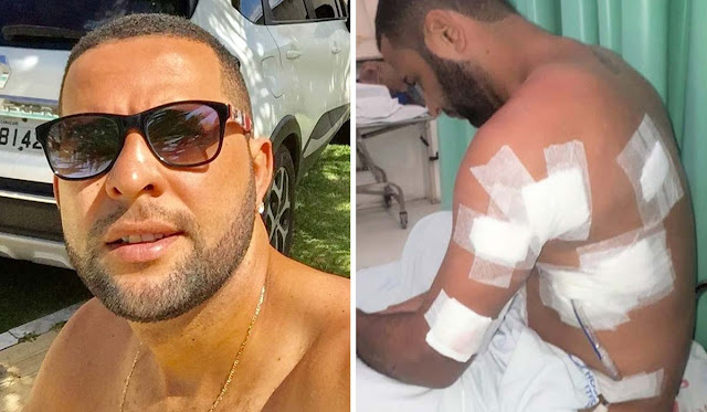 Camaçari: PM e outros dois são presos por agredir e atirar em homem que beijou rapaz