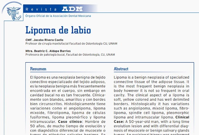 PDF: Lipoma de labio. Caso clínico