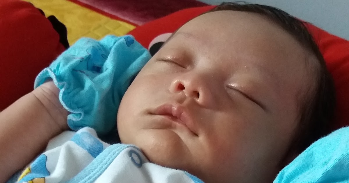 Dunia Bunda CiriCiri Alergi Susu Sapi pada Bayi