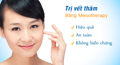 Chi phí trị vết thâm ở thẩm mỹ viện Kangnam Tri-vet-tham-an-toan-hieu-qua-cong-nghe-mesotherapy1