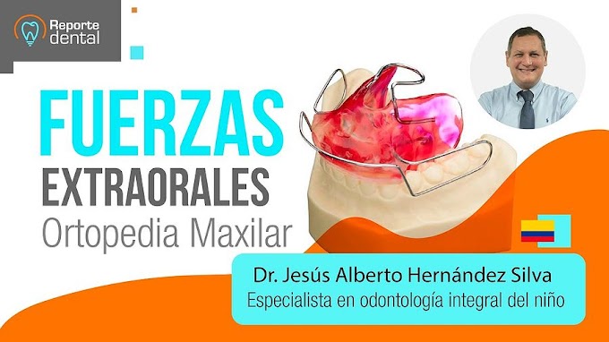 ORTOPEDIA MAXILAR: Fuerzas extraorales - Dr. Jesús Alberto Hernández Silva