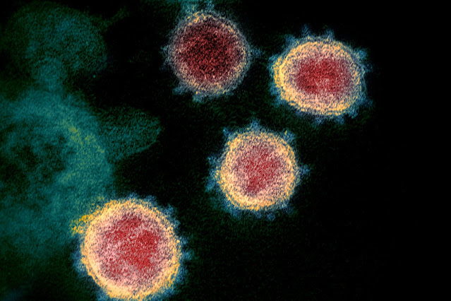 This graphic shows SARS-CoV-2 virus particles emerging from cells. The NIH-CoVnb-112 binds with a “spike protein,” blocking the virus from gaining entry to a new cell. (Photo courtesy of TJ Esparza)