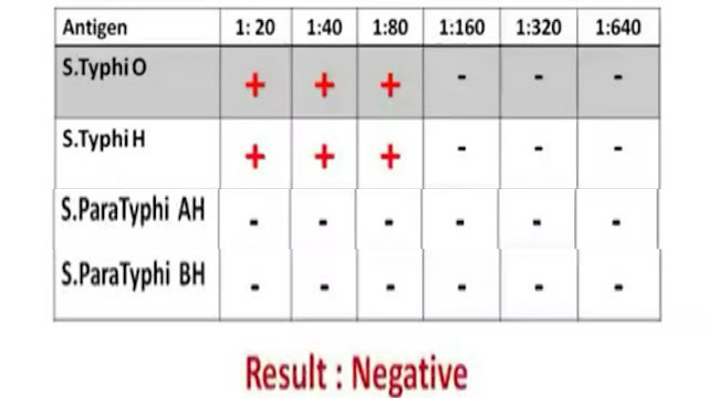 Widal test in Hindi | Widal test kya hota hai in Hindi.