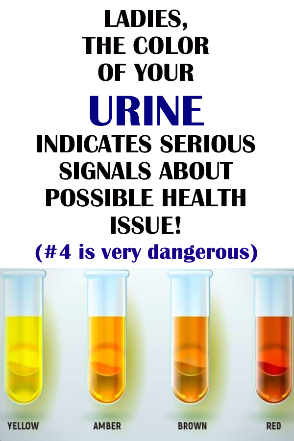 What the color of your urine and frequent urination can tell you about