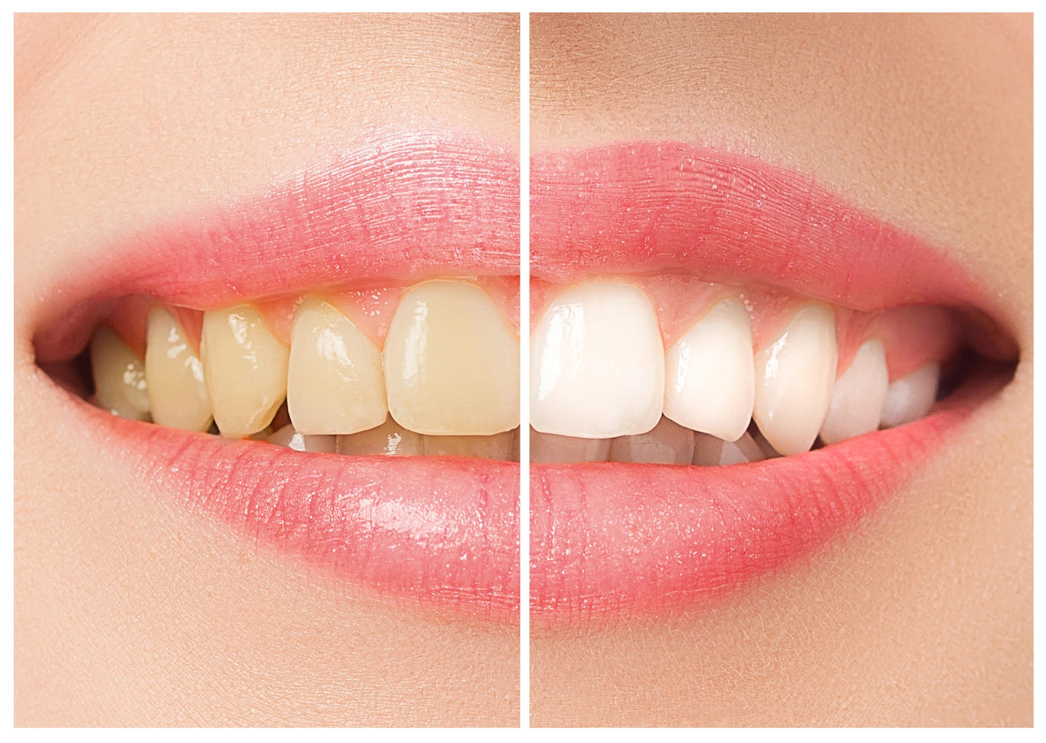 A Guide to the Different Types of Cosmetic Dentistry
