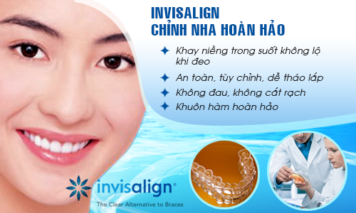 Niềng răng không mắc cài INVISALIGN