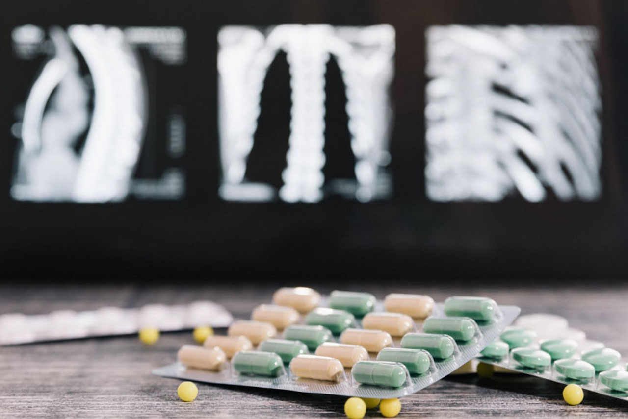 Analgesics Pain Symptom Relieving Medications