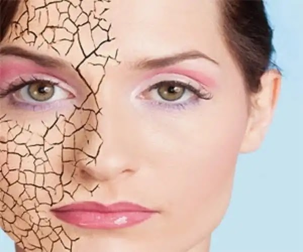 العناية بالبشرة الجافة في الشتاء العناية بالبشرة الجافة في الشتاء
