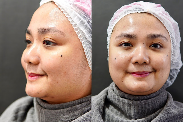 AIRIN SKIN CLINIC KEMANG AIRIN SKIN CLINIC KEMANG