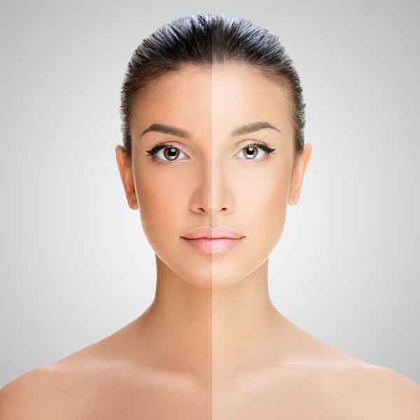 How To Remove Tan From Face Naturally