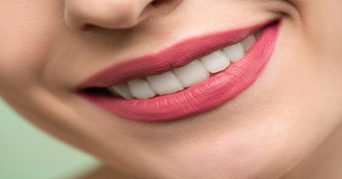 08 aliments qui causent des taches sur les dents ~ Sports et santé